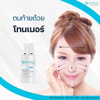 Derminet เดอร์มิเนต ศูนย์บริการรักษาสิว บางแค | Medical