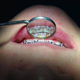 Yuttana Dental Clinic Branch 1 Lopburi | Medical