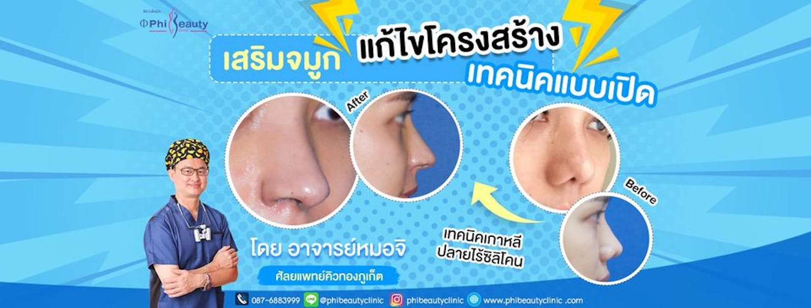 phibeautyclinic surgery phuket | Medical